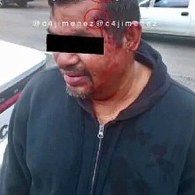 Чудеса случаются. БРОНИРОВАННЫЙ ЧЕРЕП