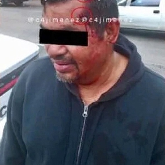 Чудеса случаются. БРОНИРОВАННЫЙ ЧЕРЕП