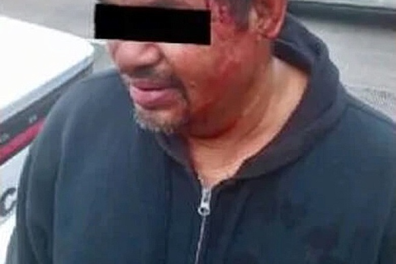 Чудеса случаются. БРОНИРОВАННЫЙ ЧЕРЕП